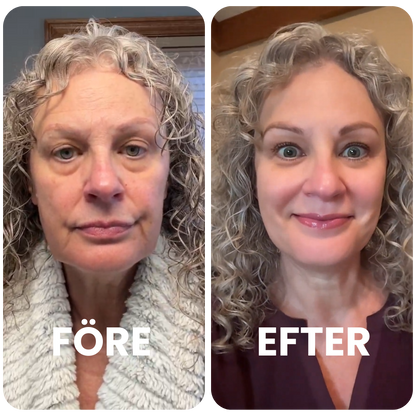 Kvinna före och efter användning av kollagenmask