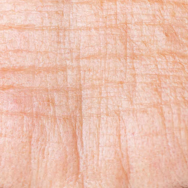 RYNKOR & FINA LINJER